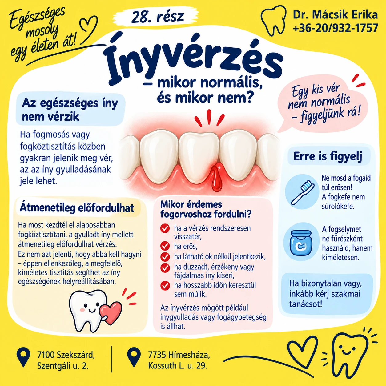 Egészséges mosoly egy életen át – 28. rész