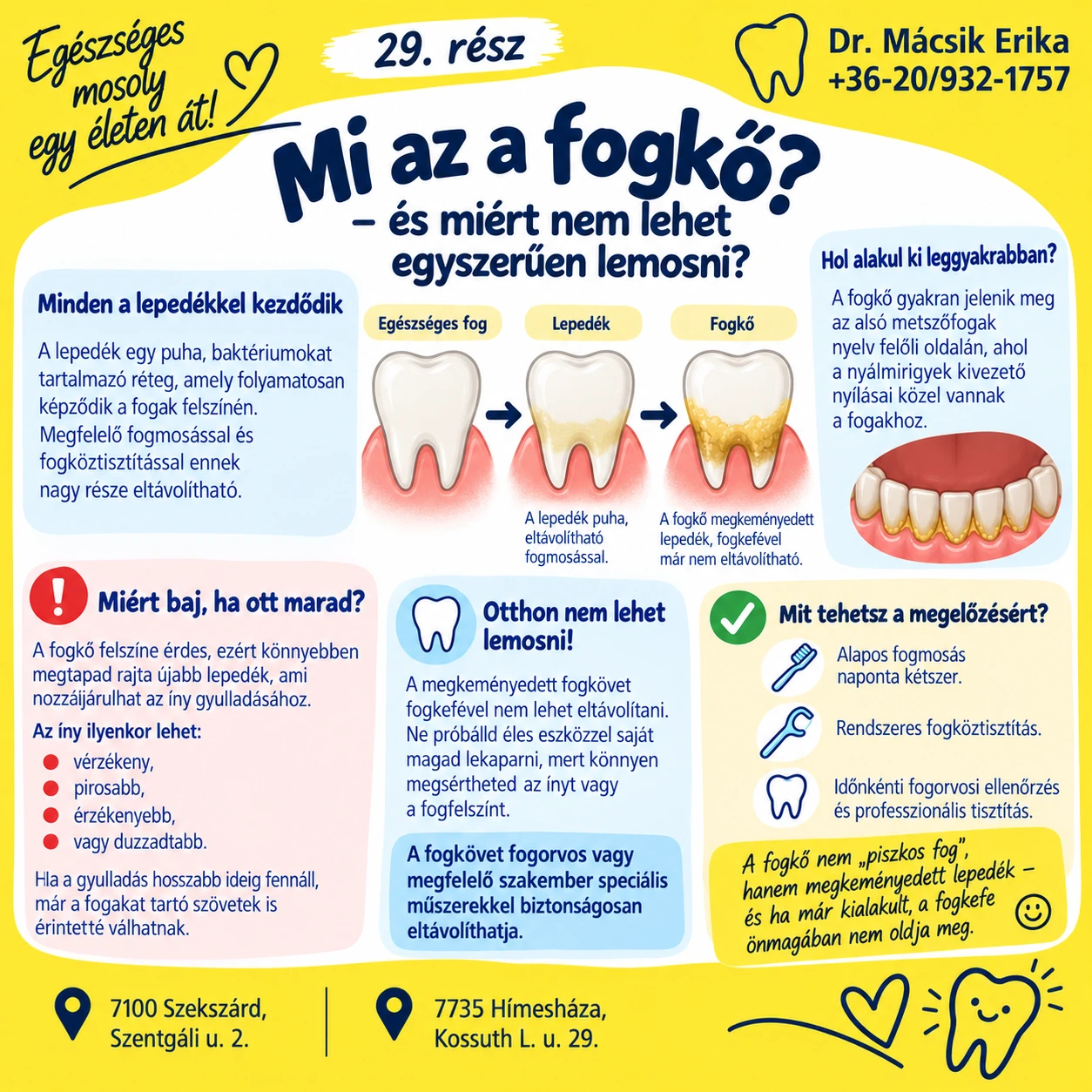 Egészséges mosoly egy életen át – 29. rész