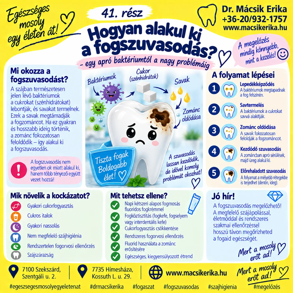 Egészséges mosoly egy életen át – 41. rész: Hogyan alakul ki a fogszuvasodás?