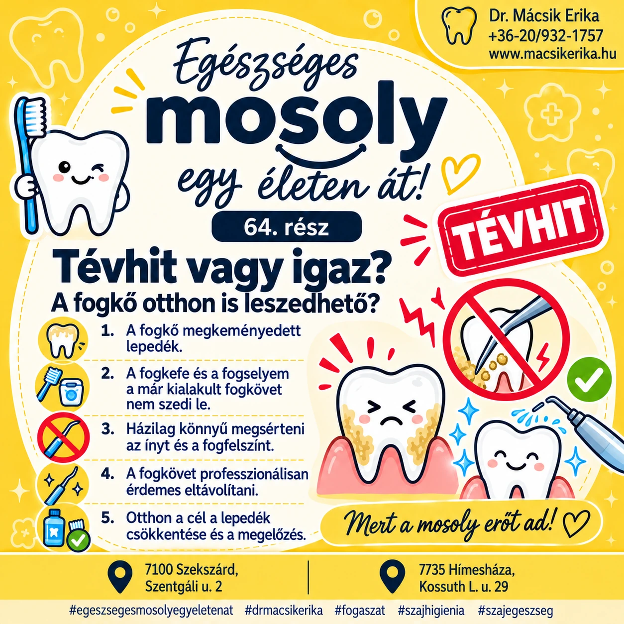 Egészséges mosoly egy életen át – 64. rész: Tévhit vagy igaz? – A fogkő otthon is leszedhető? 🦷🪨